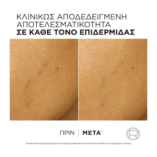 L'Oreal Paris Bright Reveal Κρέμα Απολέπισης Προσώπου