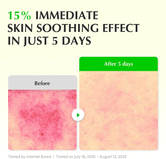 Eqqualberry Aloe PDRN Serum Calmante și Hidratant pentru Față cu Centella Asiatica și Niacinamidă pentru Strălucire 30ml