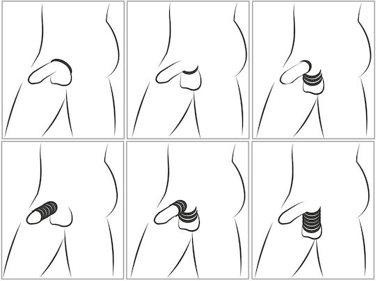 Cock & Ball Stretching Kit You2toys Set 6 Silicone Rings