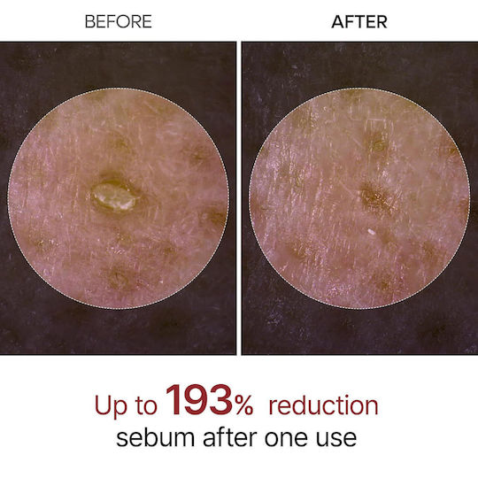 Dr. Melaxin Peel Shot Exfoliating Serum for Face Peeling 80ml