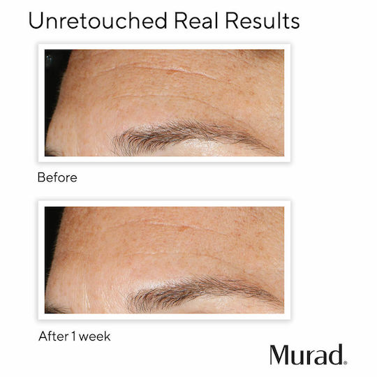 Murad Resurgence Lotion for Face Peeling 100ml