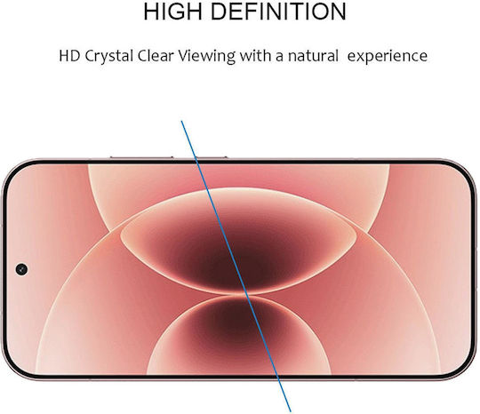 Tempered Glass Xiaomi 17T
