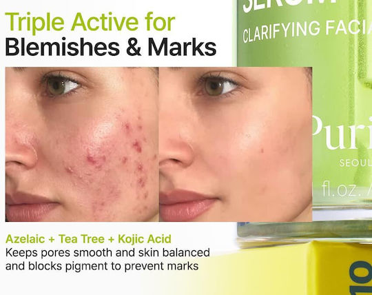 Azelaic Acid 10 Kojic Tea Tree Serum Face for Whitening & Acne 30ml
