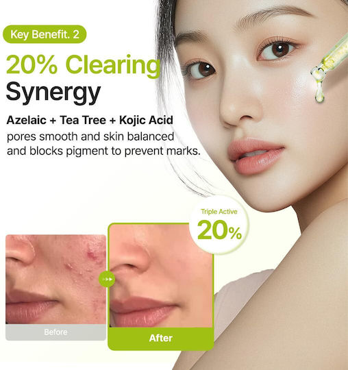 Azelaic Acid 10 Kojic Tea Tree Serum Face for Whitening & Acne 30ml