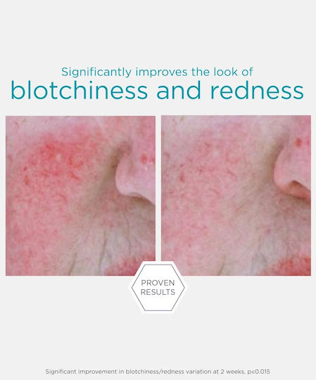Restore Redness Αντιγηραντικό Serum Προσώπου 29gr
