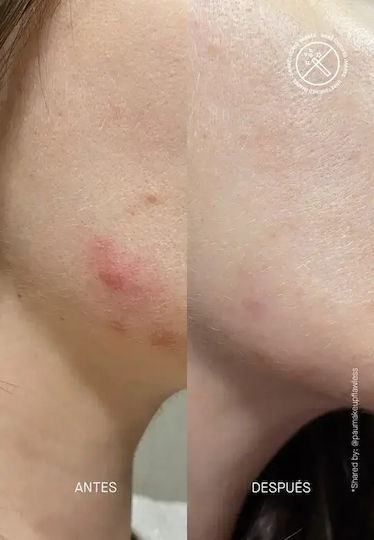 Postizit Spot Serum Discolorations 30ml