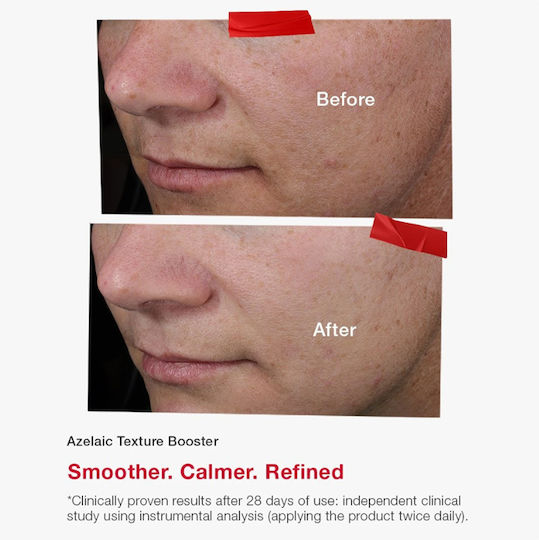 Niacinamide Tone Booster Soothing Serum Booster for Face with Niacinamide for Detoxifying and Blemishes 30ml
