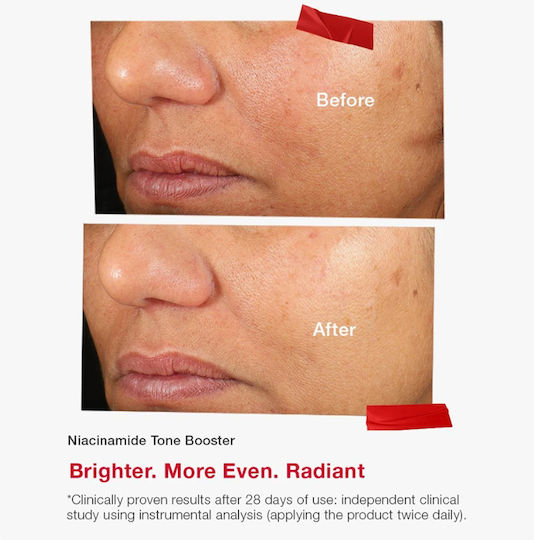 Essentials Even Tone Serum Booster For Face With Niacinamide For Brightening And Dark Spots 30ml