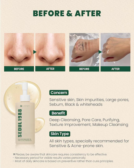 K-Secret Seoul 1988 Gesichtsreinigungsöl mit antioxidativer und talgregulierender Wirkung 200 ml