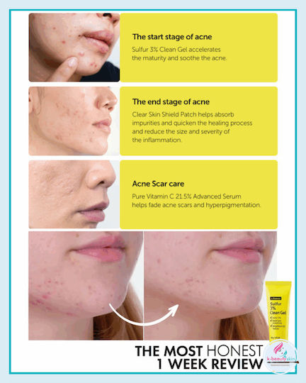 Wishtrend Sulfur 3% Gel Facial Cleanser for Oil Control & Soothing Action 30ml