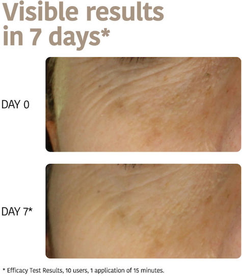 Triple Hyaluronic Acid Wrinkle Filler & Anti-Age Sheet Mask 30ml