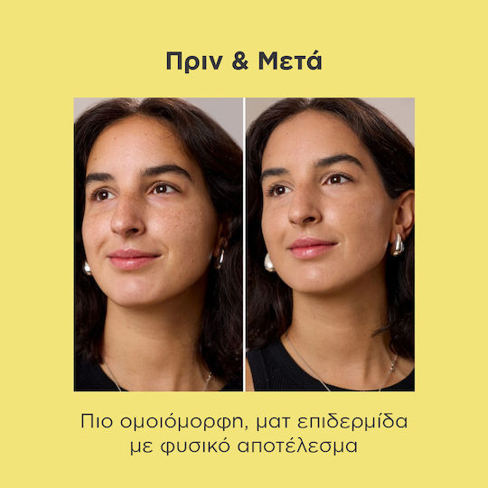 Acniben CC Ενυδατική Κρέμα Προσώπου Ημέρας με SPF30 κατά των Ατελειών 40ml