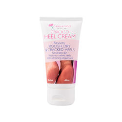 Carnation Carnation Cracked Heel Moisturizing Cream for Cracked Heels with Urea 50ml