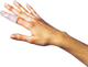 Kifidis Orthopedics Mallet finger Νάρθηκας Δακτύλου