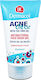 Dermacol Acne Clear Antibacterial Face Wash Gel Gel Καθαρισμού Προσώπου για Ακνεϊκές Επιδερμίδες 150ml