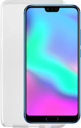 Idol 1991 Air Slim Back Cover Σιλικόνης Διάφανο...