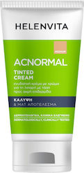 Helenvita ACNormal Κρέμα Ημέρας κατά των Ατελειών 60ml Helenvita ACNormal Κρέμα Ημέρας κατά των Ατελειών 60ml