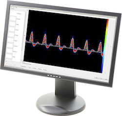 Software-ul Dopplex® Vascular Reporter Software Doppler Vascular Huntleigh