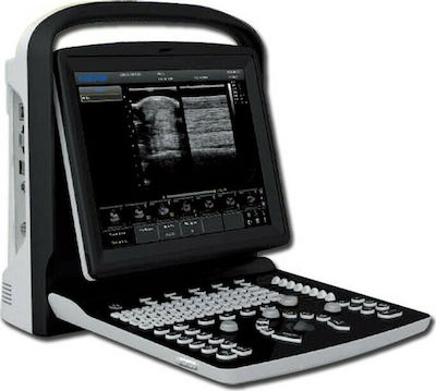 Chison ECO1 Portable Ultrasound Device