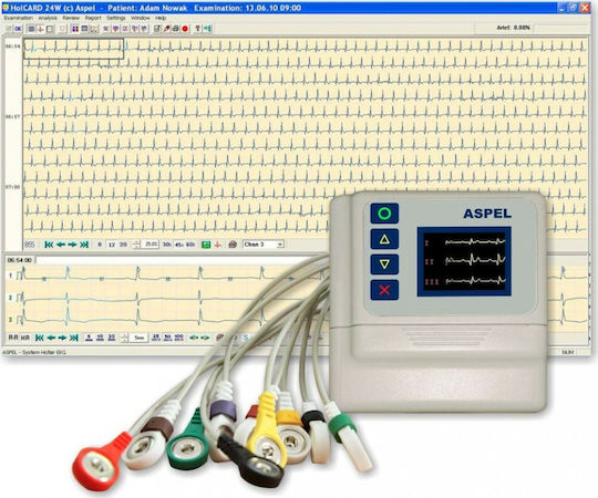 Aspel A712 Holter Rhythm with Screen 12 Leads