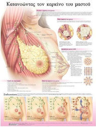 Ανατομικός Χάρτης: Κατανοώντας τον Καρκίνο του Μαστού