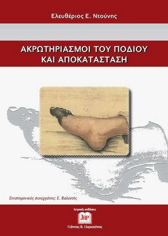 Ακρωτηριασμοί του Ποδιού και Αποκατάσταση Ακρωτηριασμοί του Ποδιού και Αποκατάσταση