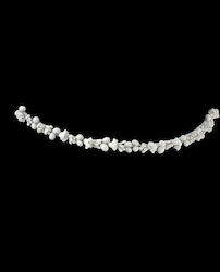 fotiadis Porcelain Wedding Crowns