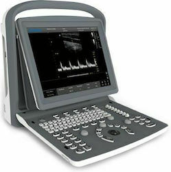Chison ECO 2 + Doppler Vaginal Array V6-A Συσκευή Φορητού Υπερήχου