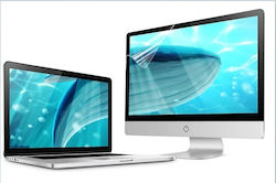 Sunshine Protecția Ecranului Pentru Laptop 14" Antiscratch HD