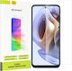 Techsuit Vision Tempered Glass (Motorola Moto G31, Moto G41, Moto G71 5 G, Moto G62 5 G)