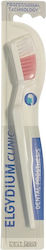 Elgydium Dental Prosthesis Toothbrush Pink Fibr...