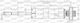Open Parts Set Amortizoare 1buc pentru Toyota Auris