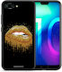 Smartfits Valentine Golden Задна корица Златист (Honor 10)