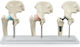 Erler Zimmer Πρόπλασμα Appendages & Joints