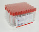 BD Αναλώσιμα Ιατρείου 100τμχ Φιαλίδια Vacutainer CAT 10ml
