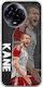 Fußballstars Harry Kane Realme 11 5g Flexibles Tpu Transparentes Silikon
