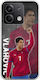 Euro 2024 Dusan Vlahovic Xiaomi Poco X6 5g Flexible Tpu Transparent Silicone