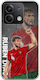 Euro 2024 Ruben Dias Xiaomi Poco X6 5g Flexible Tpu Transparent Silicone