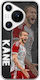 Fotbal Stele Harry Kane Huawei Pura 70 Pro TPU Flexibil Silicon Transparent