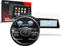 Screen Protector for Hyundai Elantra for Mini ONE Screen Protector for Hyundai Elantra for Mini ONE