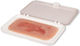 Small Arterial Ulcer Foot Wound Epithelium Phase Erler Zimmer