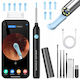 Ear Cleaning Device Otoscope Newevo Full Hd Camera 1080p 7-piece Earwax Removal Tool Kit 6 Led Lights Usb-c Charging Black