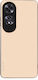 Θήκη Sonique Colorbloc Series Oppo A60 Μπεζ