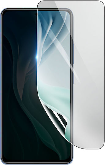 3mk Stoßfeste Hydrogel Displayschutzfolie Xiaomi Mi 11 Pro Transparent
