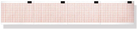 Χαρτί Ηκγ Mortara Eli 50 50x70mm X 260 Φύλλα