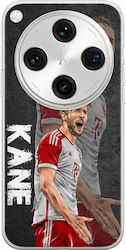 Football Stars Harry Kane Oppo Find X8 Pro 5g Гъвкав TPU Прозрачен Силикон Football Stars Harry Kane Oppo Find X8 Pro 5g Гъвкав TPU Прозрачен Силикон