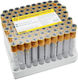 Vakuum Blutentnahme Βιοchemische Untersuchungen 5 Ml Gerinnungsaktivator & Gel Separator Τζελ Διαχωρισμού