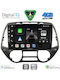 Digital IQ Car Audio System for Hyundai i20 2008-2014 Bluetooth USB WiFi GPS Apple CarPlay Android Auto with 9" Touch Screen