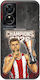 Θήκη Kings Europe 2026 Sasha Tcl 50 Se Black Tpu Μαύρη Σιλικόνη