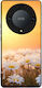 Sonique Back Cover Σιλικόνης Χρυσό (Honor Magic...